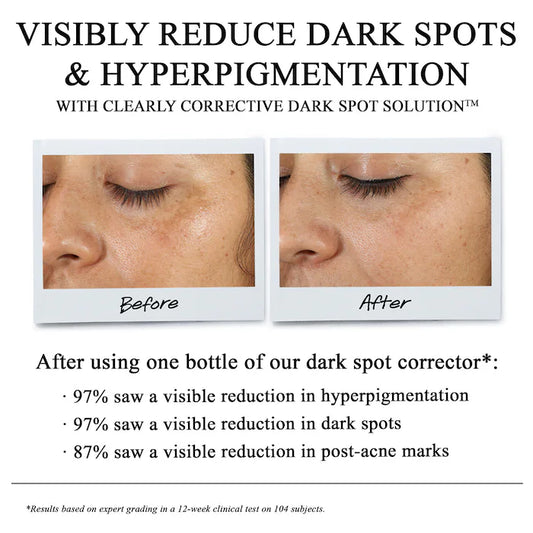 Clearly Corrective Dark Spot Correcting Serum