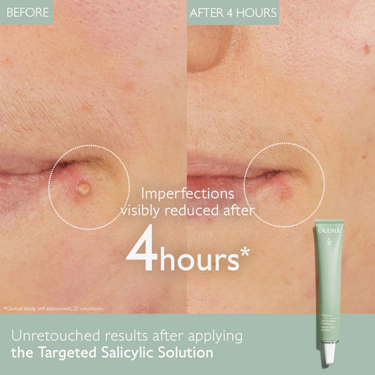 Vinopure Color Correcting Spot Solution with Salicylic Acid