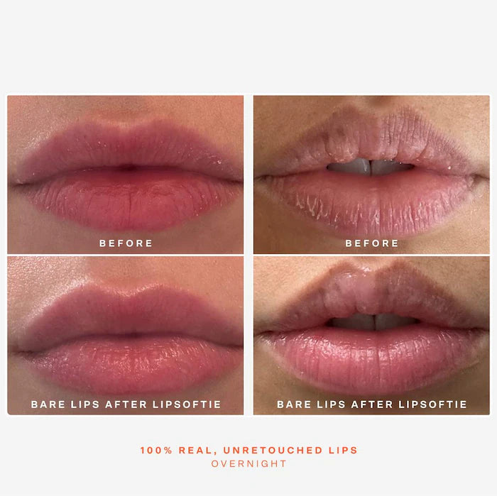 SOS LipSoftie Hydrating Lip Treatment Balm