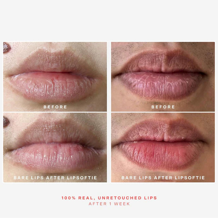 SOS LipSoftie Hydrating Lip Treatment Balm
