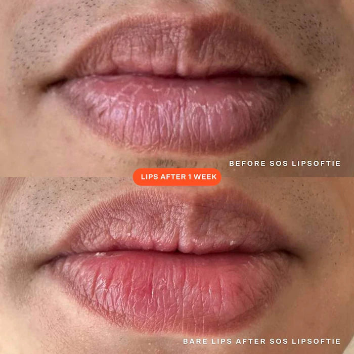 SOS LipSoftie Hydrating Lip Treatment Balm