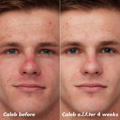 PLZ Clarify Facial Oil