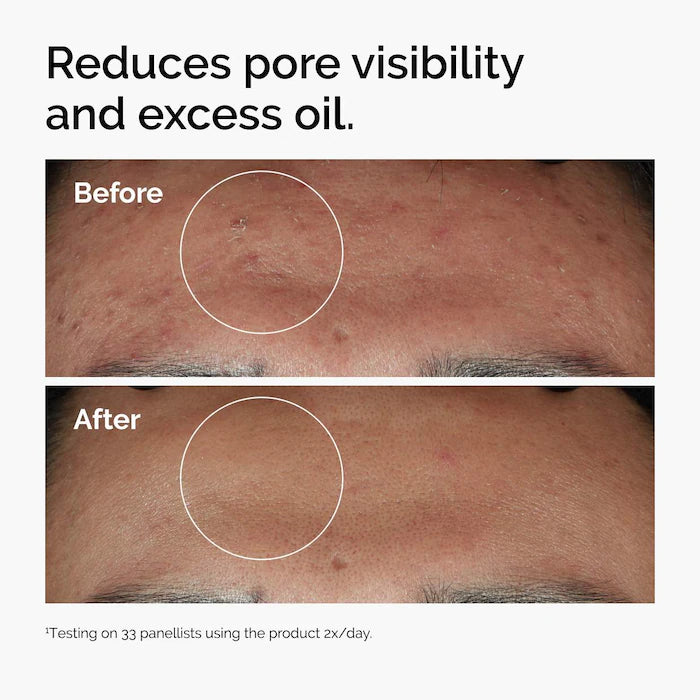 Niacinamide 10% + Zinc 1% Oil Control Serum