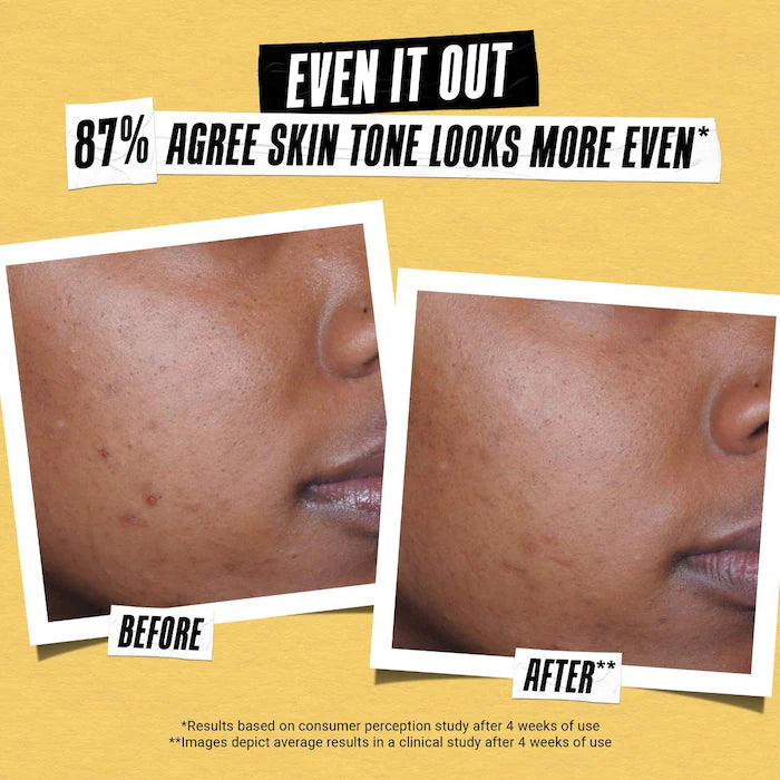 Better Screen UV Serum SPF 50+ Facial Sunscreen with Collagen Peptide