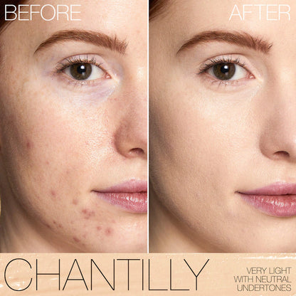 Radiant Creamy Concealer with Hydrating Medium Coverage