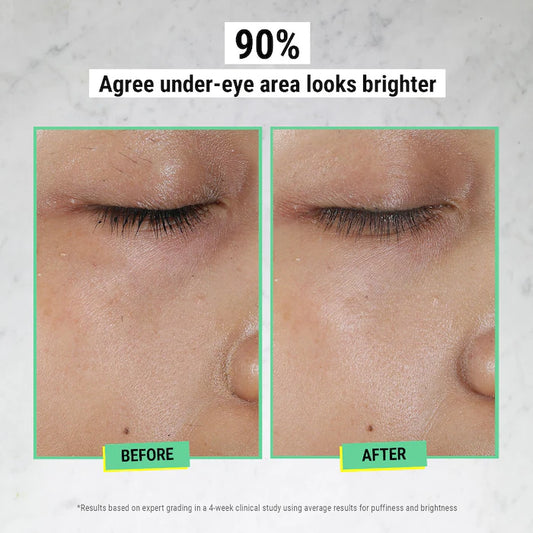 Mini Hydrating Eye Treatment Cream with Avocado