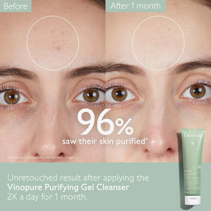 Vinopure Pore Purifying Gel Cleanser