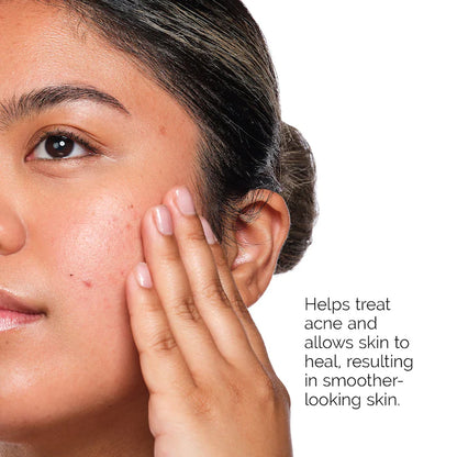 The Acne Set