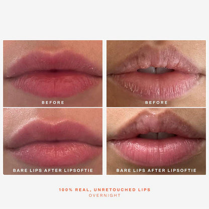 SOS LipSoftie Hydrating Lip Treatment Balm