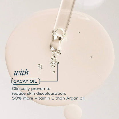 The Skin Support Oil - For Stretch Marks, Hyperpigmentation & Uneven Skin Texture