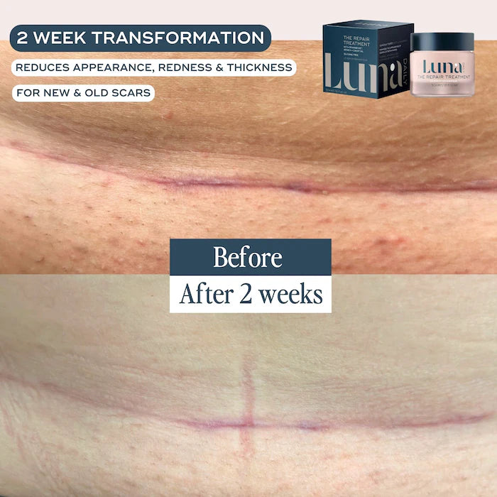 The Repair Treatment