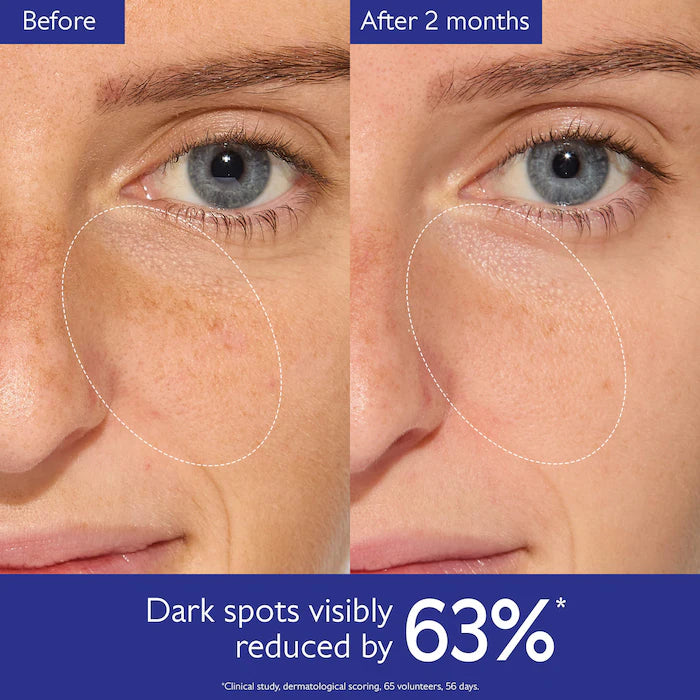 Vinoperfect Brightening Routine for Dark Spots and Uneven Skin Tone